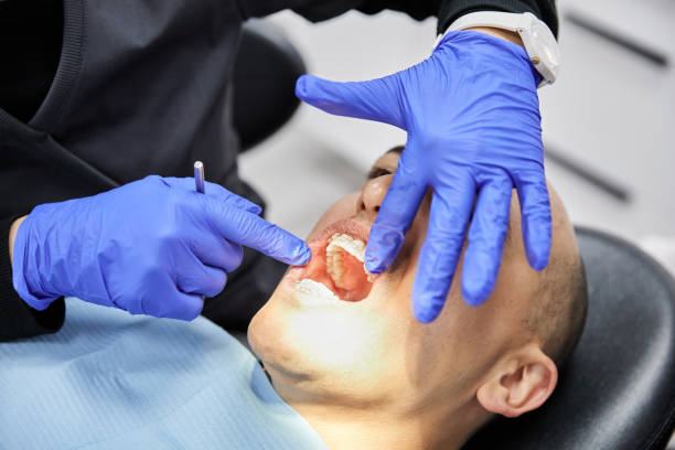 Best Broken or Cracked Tooth Emergency Dentist in Shillington, PA
